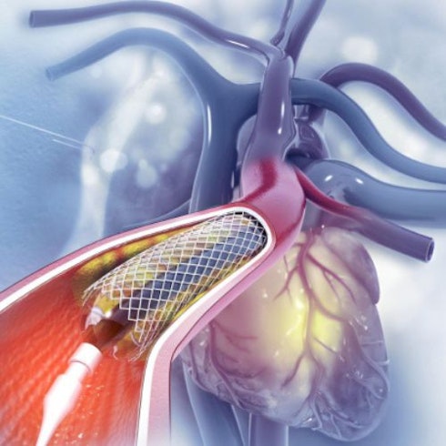 Interventional Cardiology