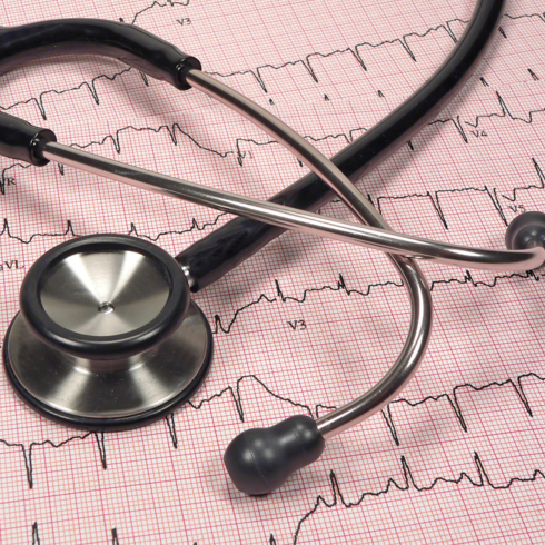 Cardiac Lab Services at HDNA Aarogyam Hospital